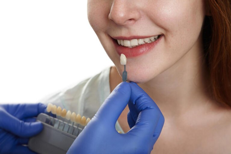 Dentista usa escala de cor para planejar facetas de resina no sorriso de paciente na Clínica Felice Odontologia, no Jd Anália Franco.